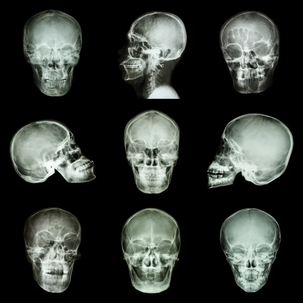 Коллекция азиатского черепа — стоковое фото