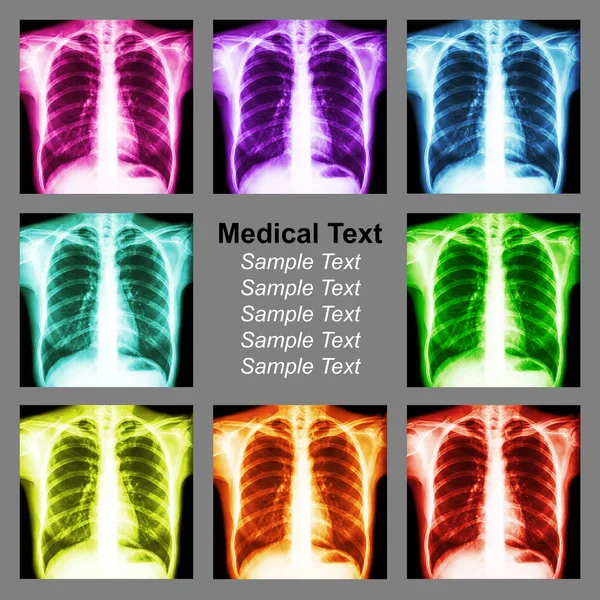 Fundo de raio-x de tórax multicolorido — Fotografia de Stock
