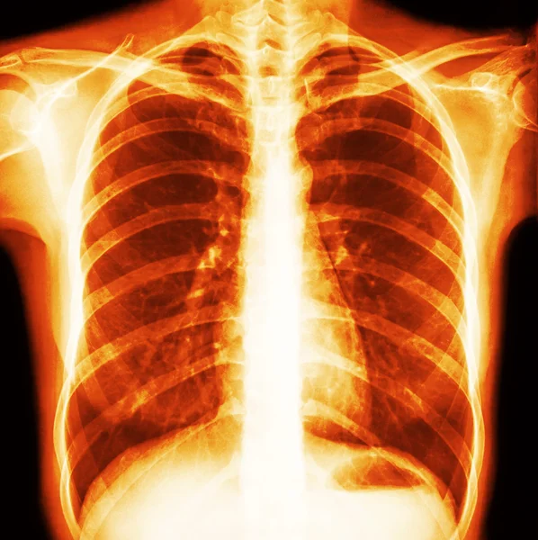 Normal human's chest — Stock Photo, Image