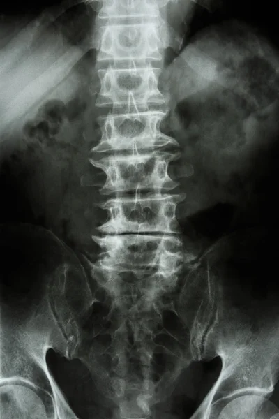 Spondyle — Zdjęcie stockowe