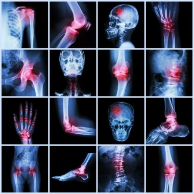 Collection human joint and arthritis and stroke clipart