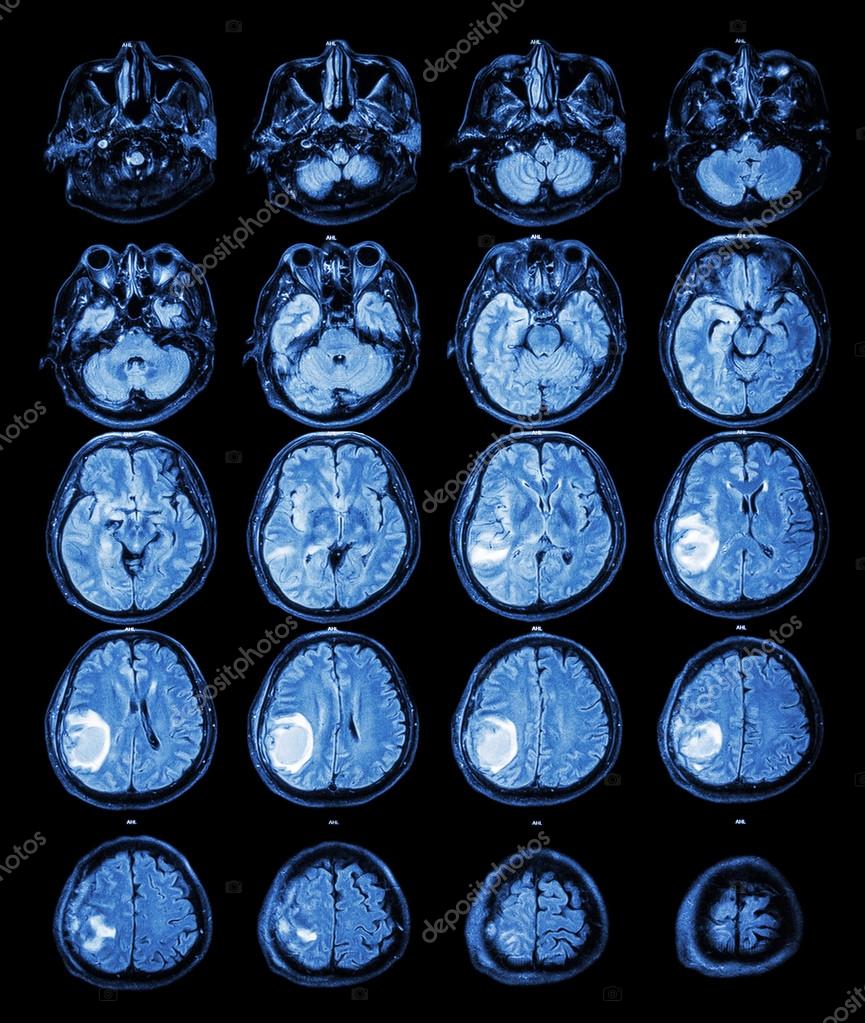 free в поисках