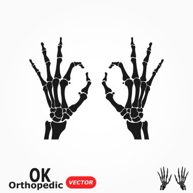 Ok ortopedik ( Ok işareti ile X-Ray insan eli )