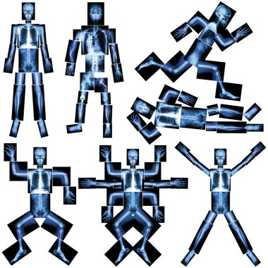 İnsan iskeleti koleksiyonu (X-Ray tüm vücut : kafatası başı yüz boyun omurga omuz kol önkol dirsek bilek el parmağı toraks akciğer kalp karın pelvis bacak diz eklem uyluk ayak bileği topuk )