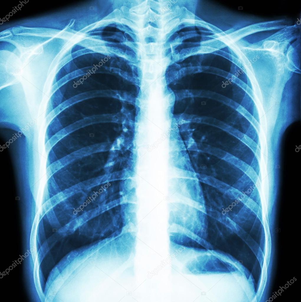 normal human's chest