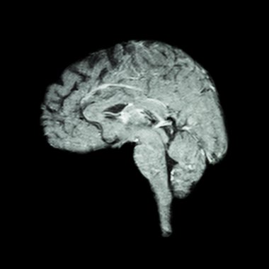 Manyetik Rezonans Görüntüleme (Mri ) beyin ( Tıp , bilim ve sağlık kavramı )