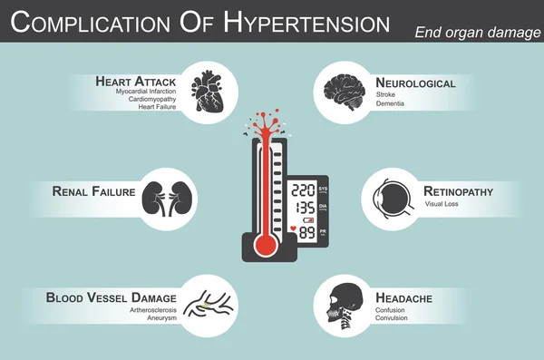 Complication of Hypertension(Heart attack : myocardial infarction , cardiomyopathy )(Brain : stroke , dementia )( visual loss )(Headache)(Renal failure)( Artherosclerosis , aneurysm ) end organ damage — Stock Vector