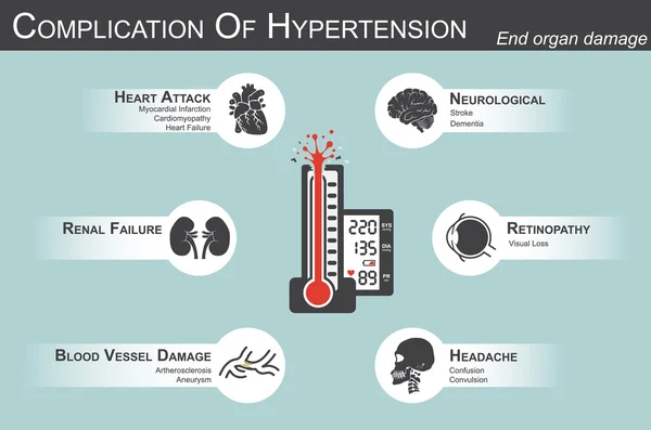 Complication de l'hypertension (crise cardiaque : infarctus du myocarde, cardiomyopathie) (cerveau : accident vasculaire cérébral, démence) (perte visuelle) (maux de tête) (insuffisance rénale) (artériosclérose, anévrisme) lésions des organes terminaux — Image vectorielle