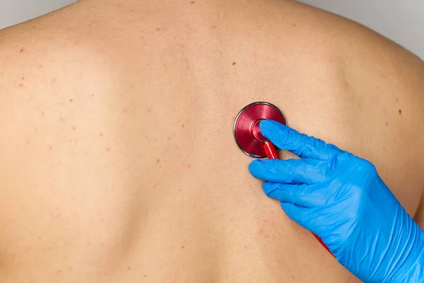 Chico en el médico de familia. área pulmonar examinada con estetoscopio. Pediatra comprueba la salud, escucha al niño con un estetoscopio. — Foto de Stock