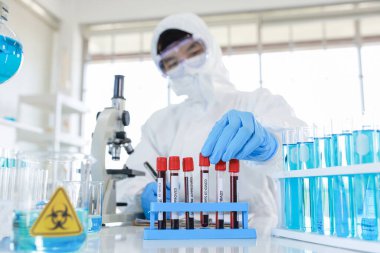 Concept to represent the 2020 virus threat Coronavirus, blood in a test tube. 
