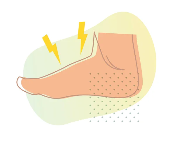 Fußschmerzen Arthritis Symbol Als Eps Datei — Stockvektor