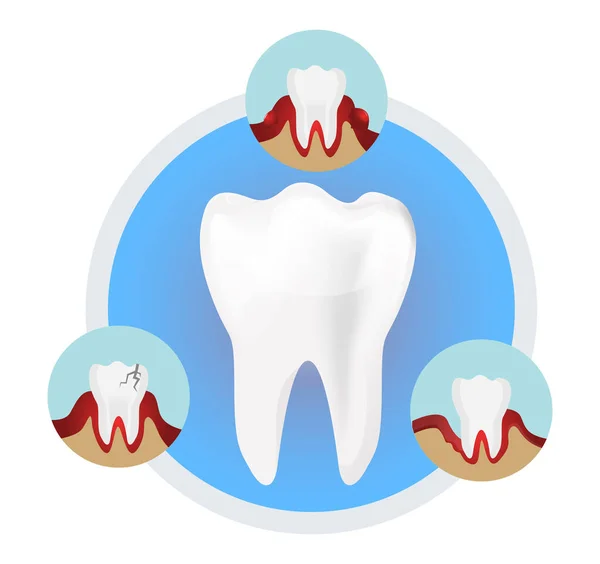 Dientes Blancos Enfermedad Las Encías Ilustración Stock Como Archivo Eps — Archivo Imágenes Vectoriales