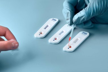 Coronavirus SARS-CoV-2, Covid-19 için antikorlar için COVID-19 testi yapın. Eldivendeki sıhhiyenin eli pipetle teste kan uyguluyor. Hasta parmaklar, mavi nane arkaplanı.