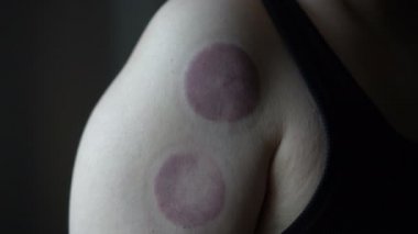 Kan dolaşımı ve ağrı kesiciler için alternatif tedavi yöntemleri.