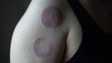 Kan dolaşımı ve ağrı kesiciler için alternatif tedavi yöntemleri.