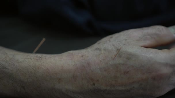 Arm Hand Chinese Alternatieve Naald Sacupunctuur Behandeling Voor Ouderen Ouderen — Stockvideo