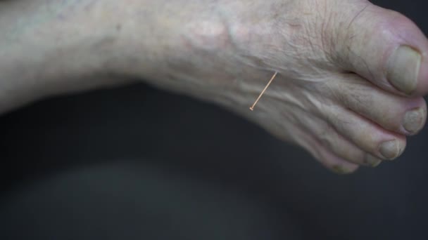 Pieds Avec Aiguille Chinoise Acupuncture Pour Ajuster Équilibre Yin Yang — Video