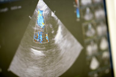 Modern ultrason makinesi