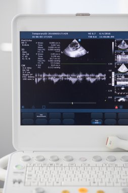 Modern ultrason makinesi