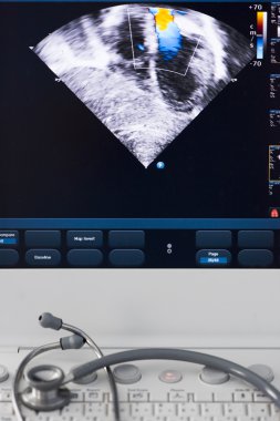 modern ultrasound machine clipart