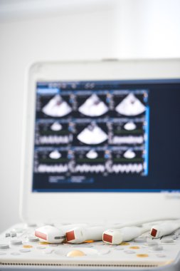 modern ultrasound machine clipart