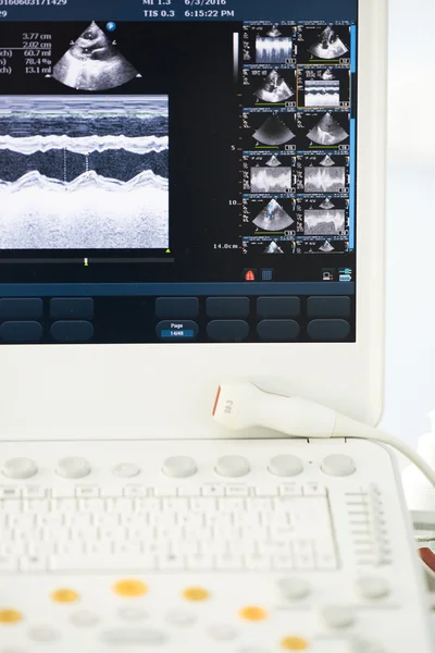 Modern ultrasound machine — Stock Photo, Image