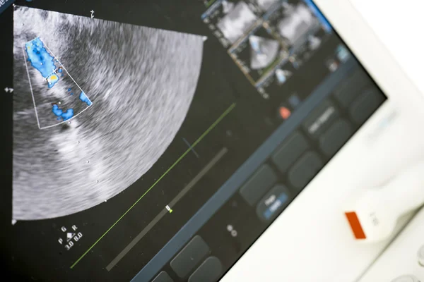 Moderne echografie machine — Stockfoto