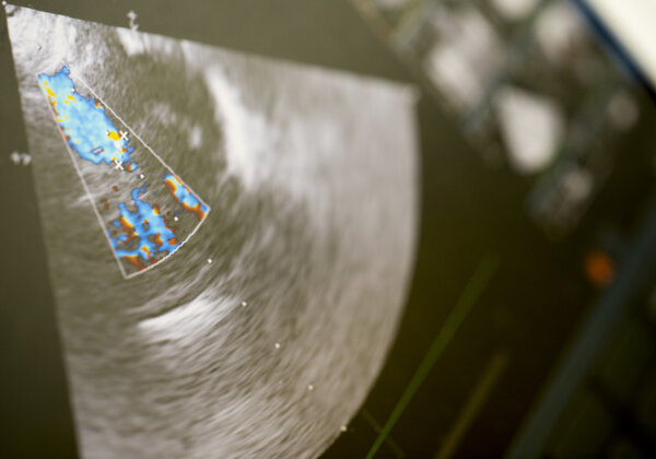 Современная ультразвуковая машина
