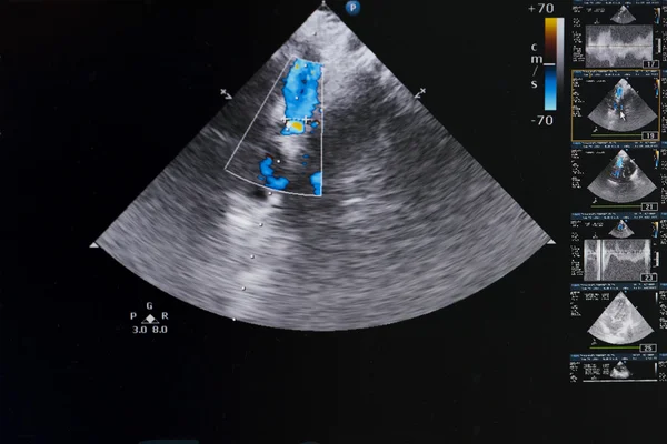 Modern ultrasound machine — Stock Photo, Image