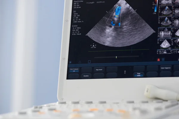 Modern ultrasound machine — Stock Photo, Image