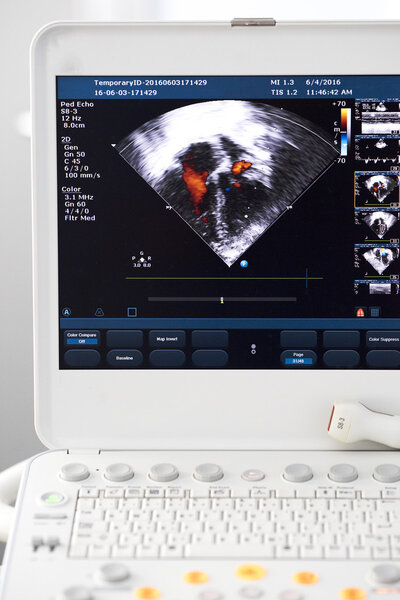 Современная ультразвуковая машина
