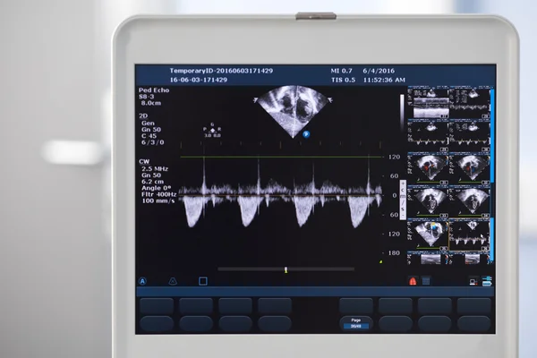 Máquina de ultrasonido moderna — Foto de Stock