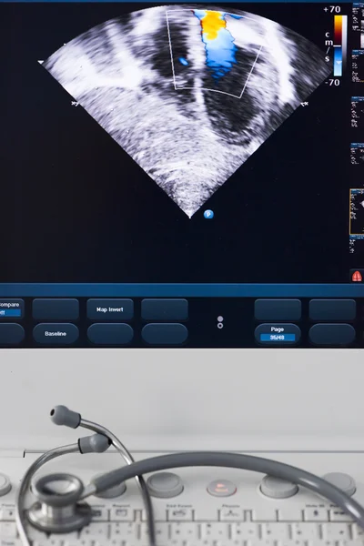 Moderna macchina ad ultrasuoni — Foto Stock