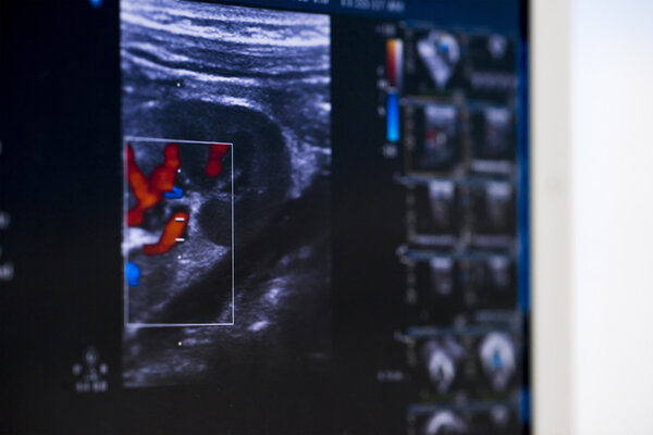 Современная ультразвуковая машина
