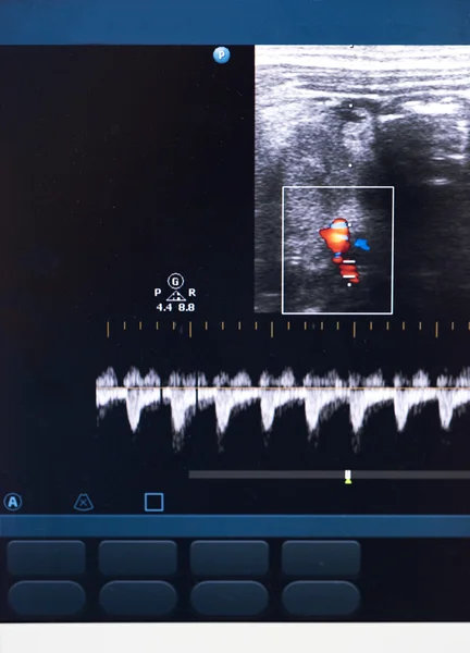 Modern ultrason makinesi — Stok fotoğraf