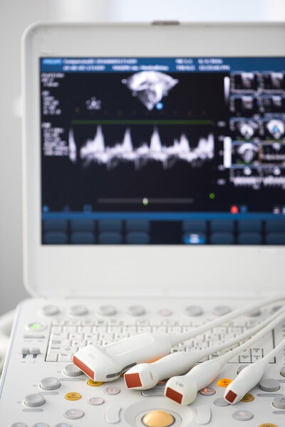 Современная ультразвуковая машина
