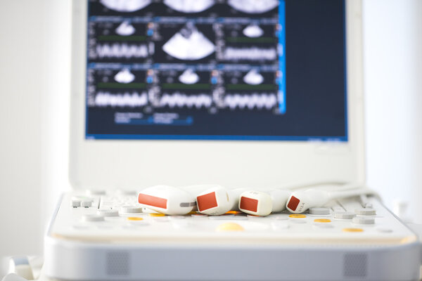 Современная ультразвуковая машина
