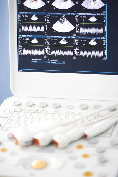 Modern ultrasound machine — Stock Photo, Image