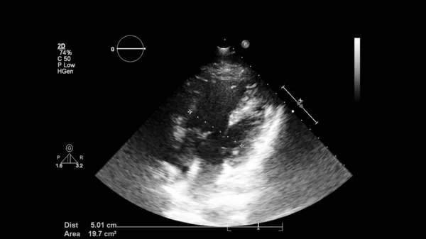 Bild Hjärtat Gråskala Transesofagalt Ultraljud — Stockfoto