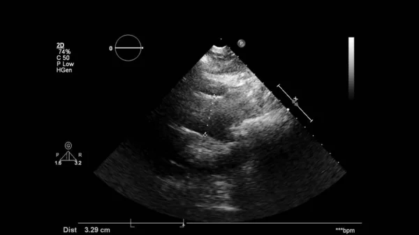 Transesofageal Ultrason Sırasında Kalbin Gri Ölçekli Görüntüsü — Stok fotoğraf