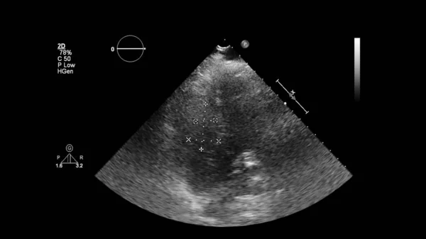 経食道超音波検査時のグレースケールモードで心臓の画像 — ストック写真
