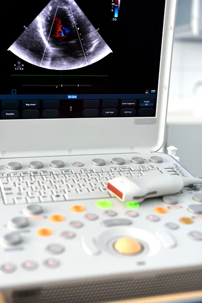 Ultrasound machine — Stock Photo, Image