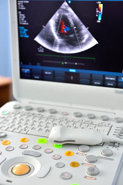 Ultrasound machine — Stock Photo, Image