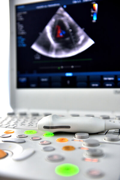 Ультразвуковая машина