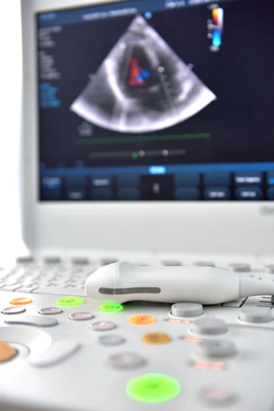 Ultrasound machine — Stock Photo, Image