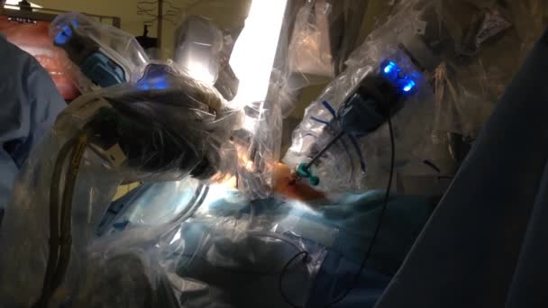 Малоінвазивна хірургія — стокове відео