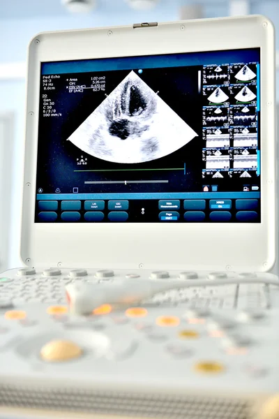 Máquina de ultrasonido — Foto de Stock