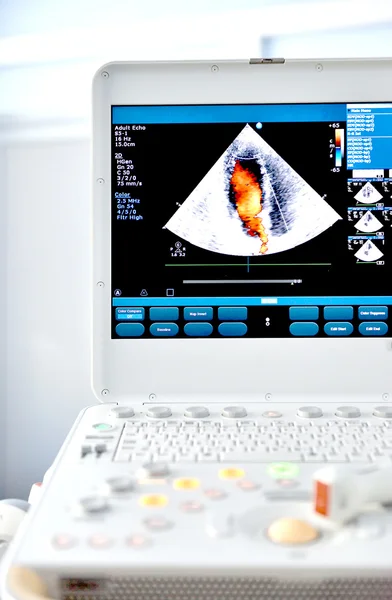 Mesin Ultrasound — Stok Foto