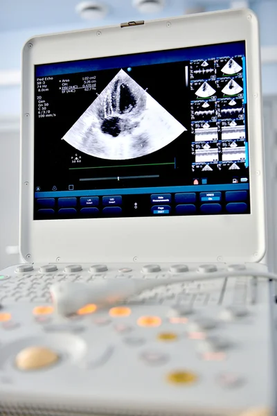 Ultrasound machine — Stock Photo, Image