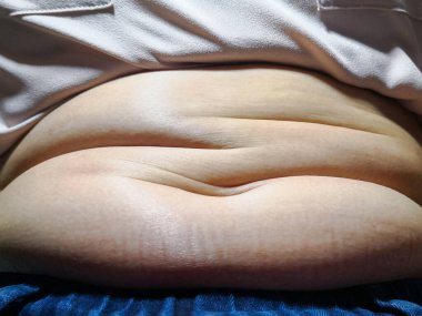 Göbeğinde aşırı yağ olan kadın vücudu..